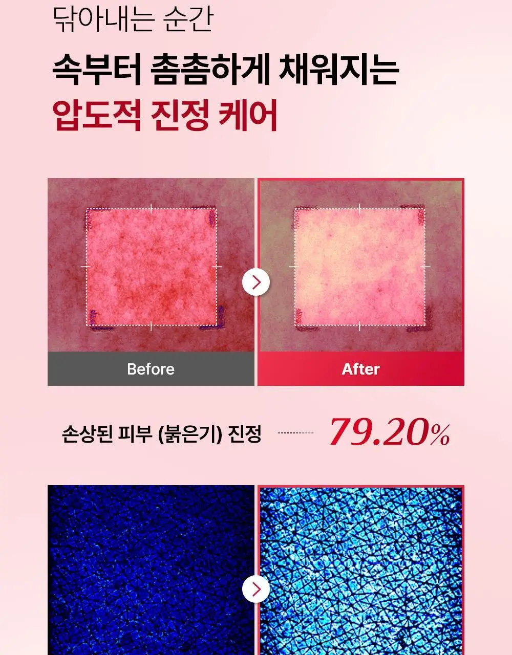 [리뉴얼/원조패드]코스알엑스 원스텝 패드 100매 4종 중 택1 상세페이지 27
